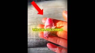 This Man Rescued A Lifeless Hedgehog.