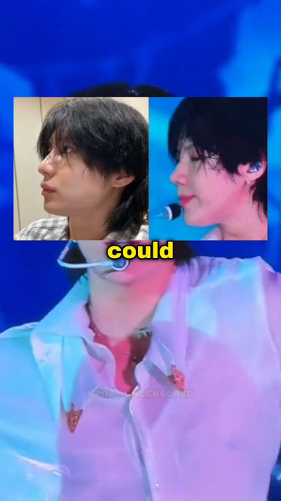 What Happened to Taemin’s Nose? #kpop
