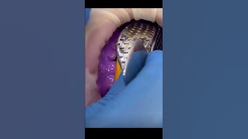 lấy dấu hàm #răngsứthẩmmỹ #răngsứ #veneers #dental #dentist #shortvideo #shorts #short