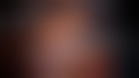 4DryField® PH - Hemostasis during da Vinci® partial nephrectomy