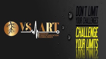 Intravascular Lithotripsy IVL in Below-the-Knee Lesions Breaking New Ground in Complex Interventions