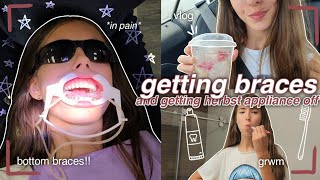 getting bottom braces vlog! 🫶✨️ (& taking off herbst appliance)