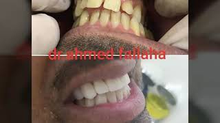 مجمع نوفا حي الروضة لطب الاسنان screenshot 2