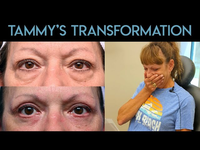 Tammy's Transformation