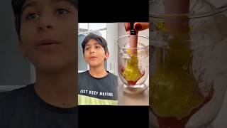 Abim Kekeme Hastası Olduğu İçin Ona Süpriz Yaptım