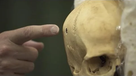 ¿Qué bala puede penetrar un cráneo?
