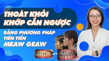 Niềng Răng Thoát Khỏi Khớp Cắn Ngược Bằng Phương Pháp Tiên Tiến Meaw Geaw | Nam Bùi Vinalign
