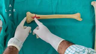 TIBIA