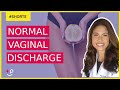 Vaginal Discharge Types. What