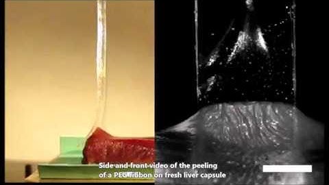 Interfacial fluid transport is a key to hydrogel bioadhesion