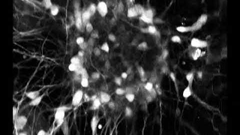 Calcium Signaling in Developing Neurons