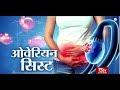 Ayushman Bhava : Ovarian Cyst | ओवेरियन सिस्ट