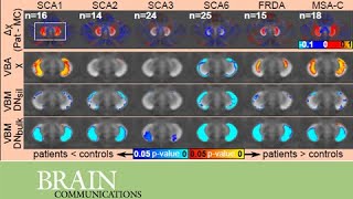 Quantitative susceptibility mapping in degenerative cerebellar ataxias