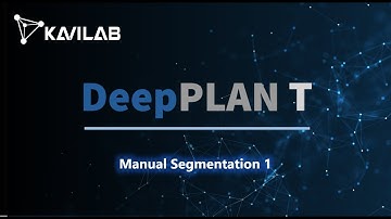 DeepPLAN T: #2 Manual Segmentation 1