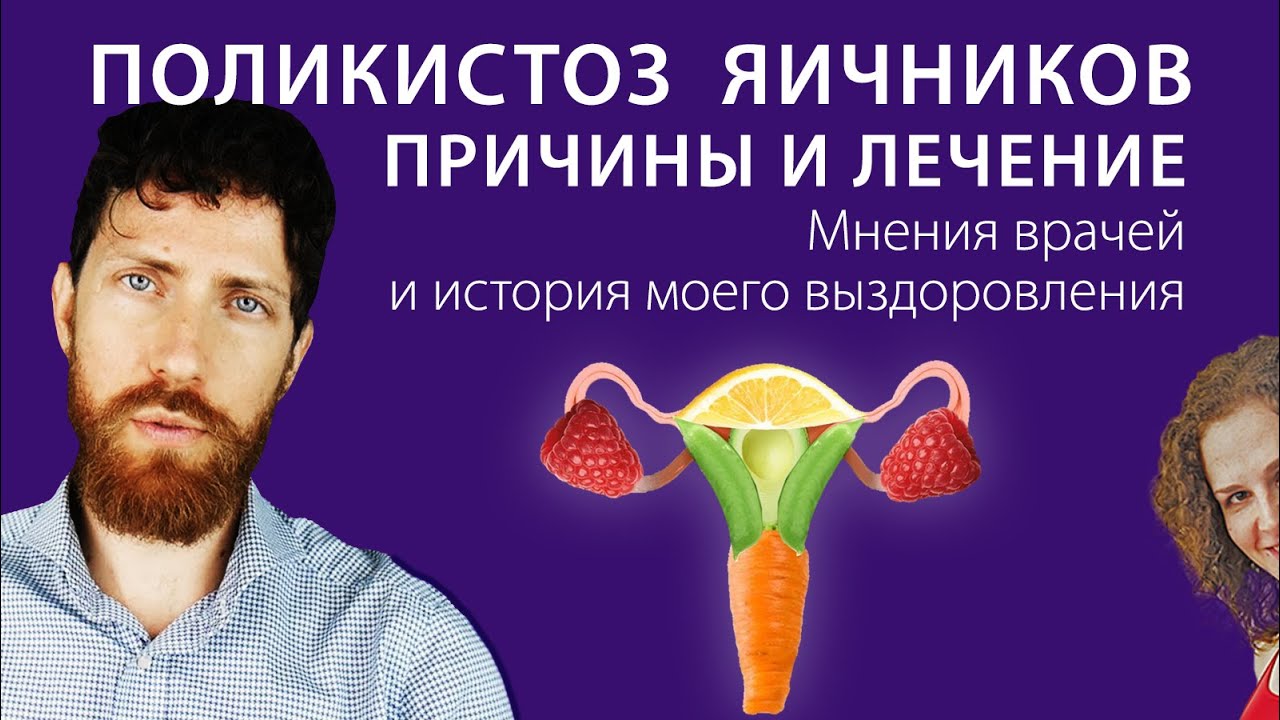 Причины и лечение синдрома поликистозных яичников. Мнения врачей и мой ...