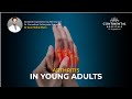 Arthritis in young adults  continental hospitals