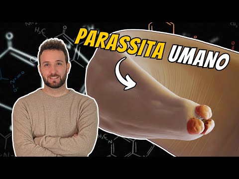 EVERYTHING You NEED TO KNOW about Ascaris lumbricoides