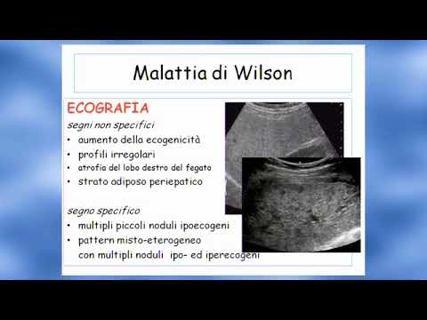 Video: Differenza Tra Cellule Di Kupffer Ed Epatociti