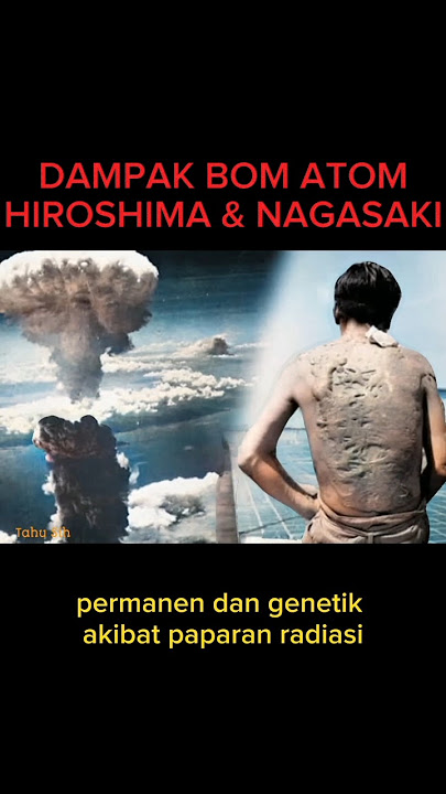 Dampak Bom Atom Hiroshima dan Nagasaki Masih Terasa #shorts
