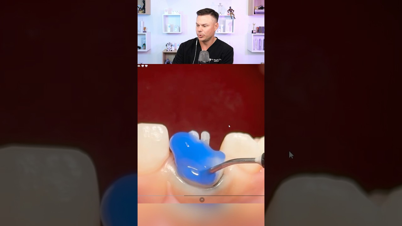 Dentist Reveals What This Blue Liquid REALLY Is! 😮🦷