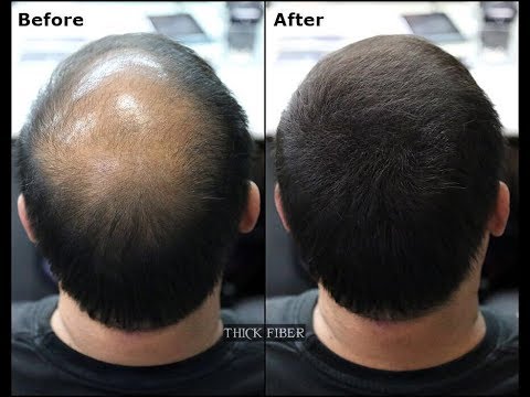THICK FIBER | Hair Building Fibers is a hair loss concealer fiber. Cover up  Bald patches - YouTube