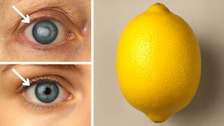 I Was Blind, but Now I See — 50 Lemon Recipes