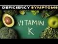 VITAMIN K DEFICIENCY SYMPTOMS || Top 10 Deficiency Symptoms of VitaminK #vitamink #vitamindeficiency