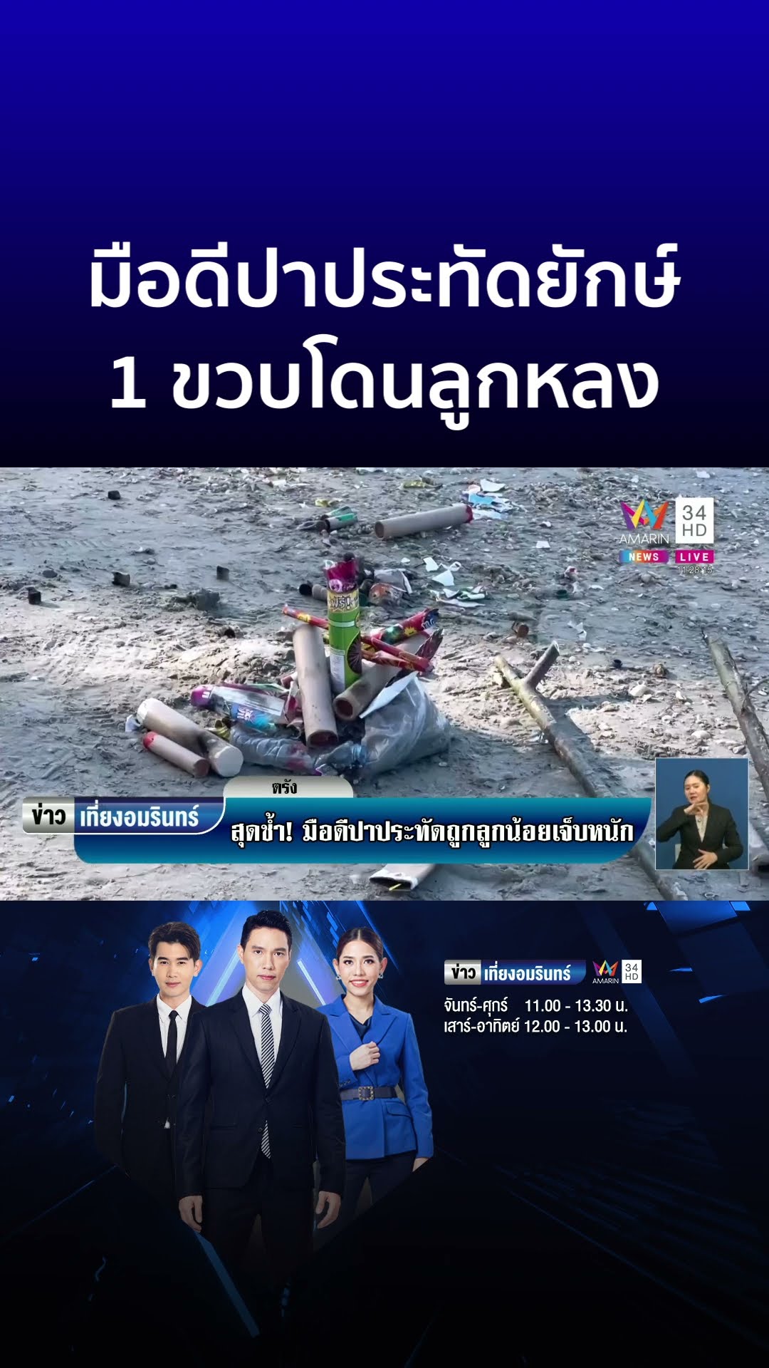 หัวใจแม่ช้ำ มือดีปาประทัดยักษ์ ถูกลูกน้อยแผลไหม้เย็บ 7 เข็ม | ข่าวเที่ยงอมรินทร์