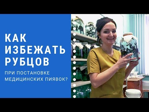 Вопрос: Сообщение про пиявок, как написать?