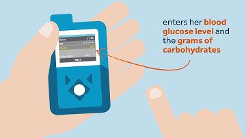Bolusing in Auto Mode. - MiniMed 670G system.