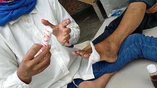 BEGINI CARA MERBAN LUKA DI JENTIK KAKI