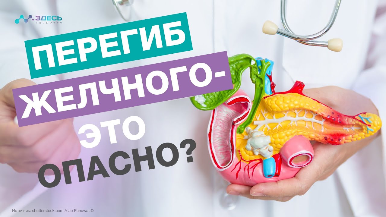 ПЕРЕГИБ ЖЕЛЧНОГО ПУЗЫРЯ - это ОПАСНО?