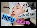 ทำ HIFU ครั้งแรก หน้าเรียวจริงมั้ย เหนียงหายจริงหรอ Chanisa clinic I Prawwave