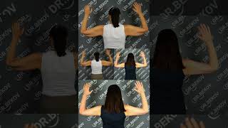 Лазерная брахиопластика Laser brachioplasty, result 3.5 months after surgery