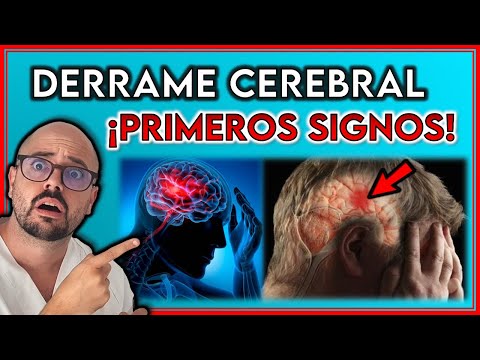 ESTOS son los PRIMEROS SIGNOS de un DERRAME CEREBRAL || ¡SEÑALES que no Debes IGNORAR!