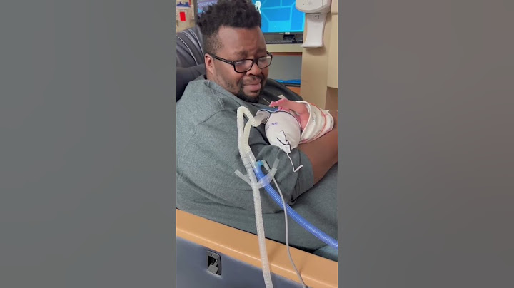 Dad sings worship song to son in NICU and he raises his little hand in praise ❤️❤️