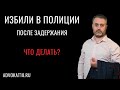 Избили полицейские и поместили в ИВС - что делать и как реагировать? Избиение после задержания