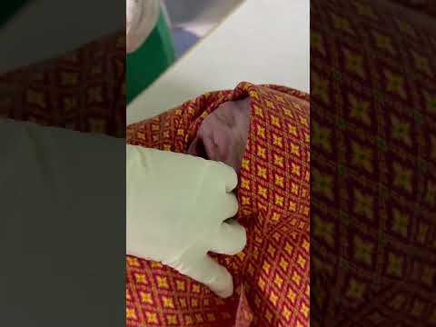 Do You Know Why Baby Eyes Is 