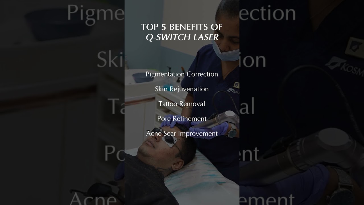 Top 5 benefits of Q - Switch Laser