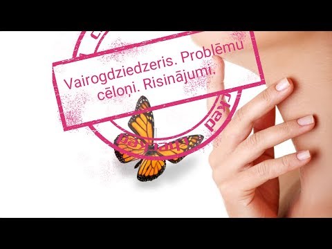 Video: Vairogdziedzera Biopsija - Rezultāti, Uzvedība