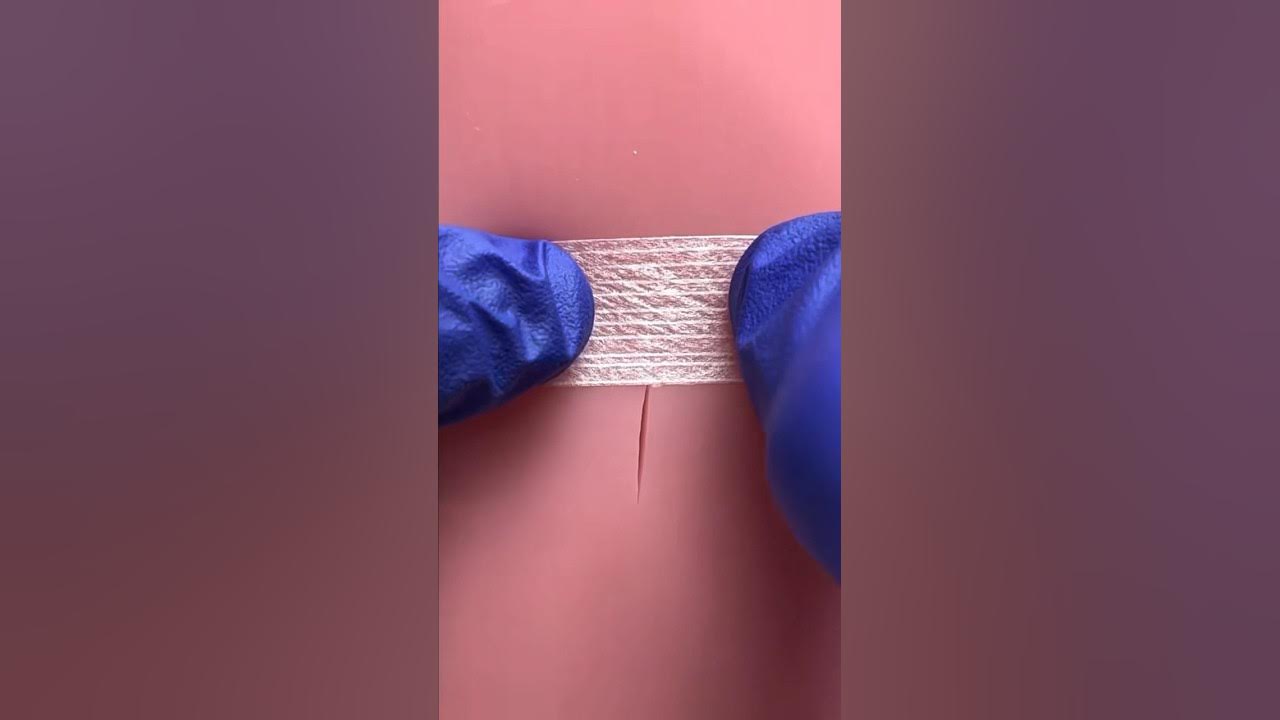 how-to-apply-steri-strips-youtube