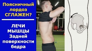 Почему Поясничный Лордоз Выпрямлен. Как Его Восстановить?