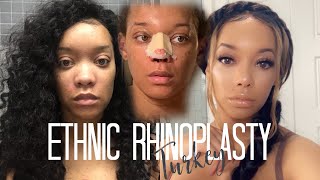 RHINOPLASTY Q&A| I GOT A NOSE JOB IN TURKEY and this happened... | Peyton Charles
