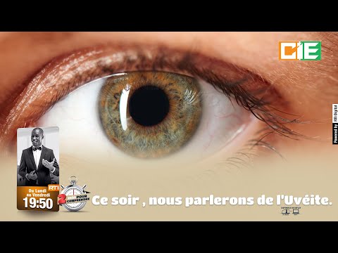 Vidéo: Composer avec des yeux secs ou un diagnostic de KCS chez le chien