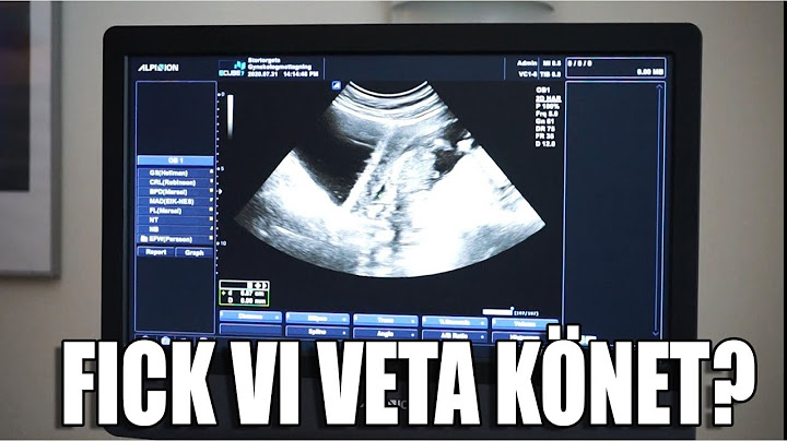 FÖRSTA ULTRALJUDET | vlogg
