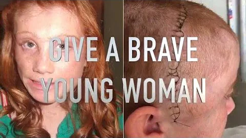 After having half her brain removed, Karley's dream is to be a photographer