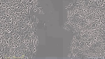 HT1080 Cells HSP90 Inhibitor
