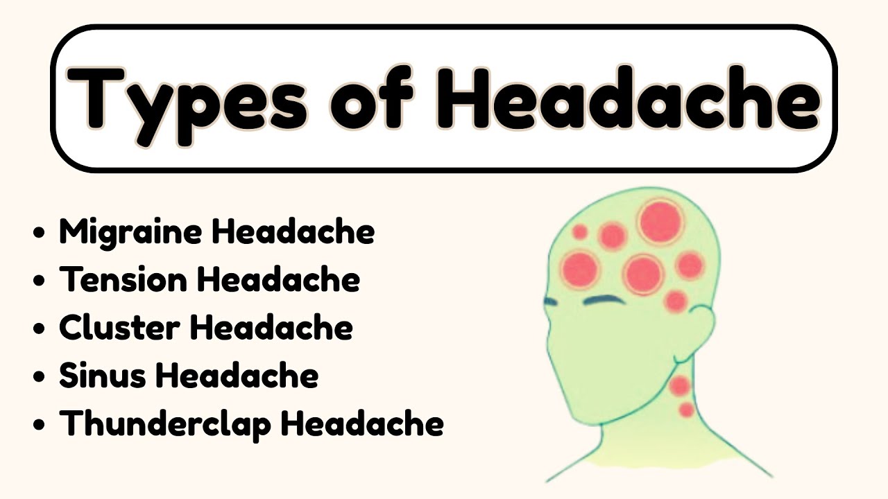 Types Of Headache Migraine Tension Headache Cluster Headache Types of headache migraine tension headache cluster headache