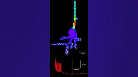 Synaptic stimulation triggers a calcium wave in a layer 5 pyramidal neuron of rat prefrontal cortex