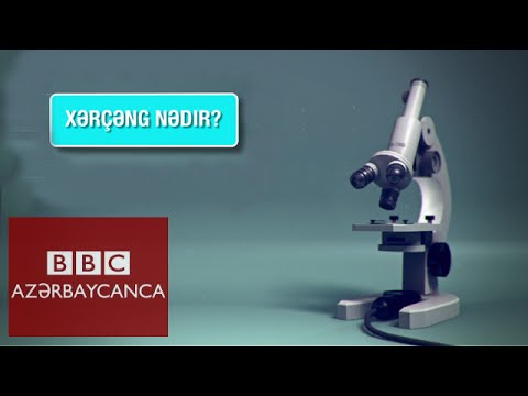 Xərçəng nədir? - izahedici video